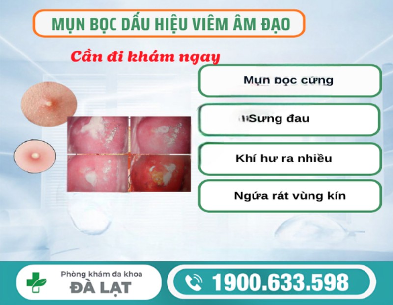 Hình ảnh minh họa